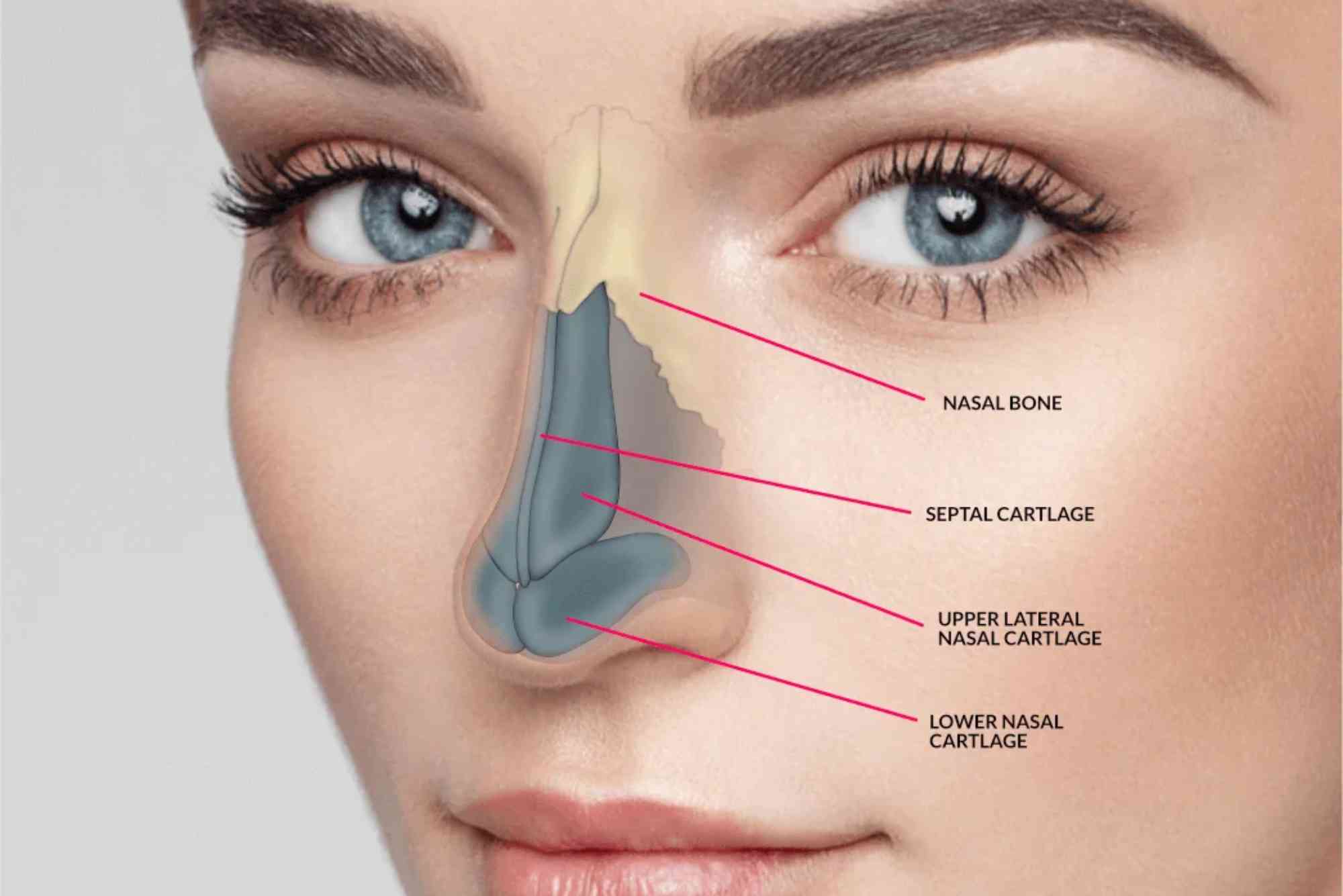Does Insurance Cover Rhinoplasty in the UAE?