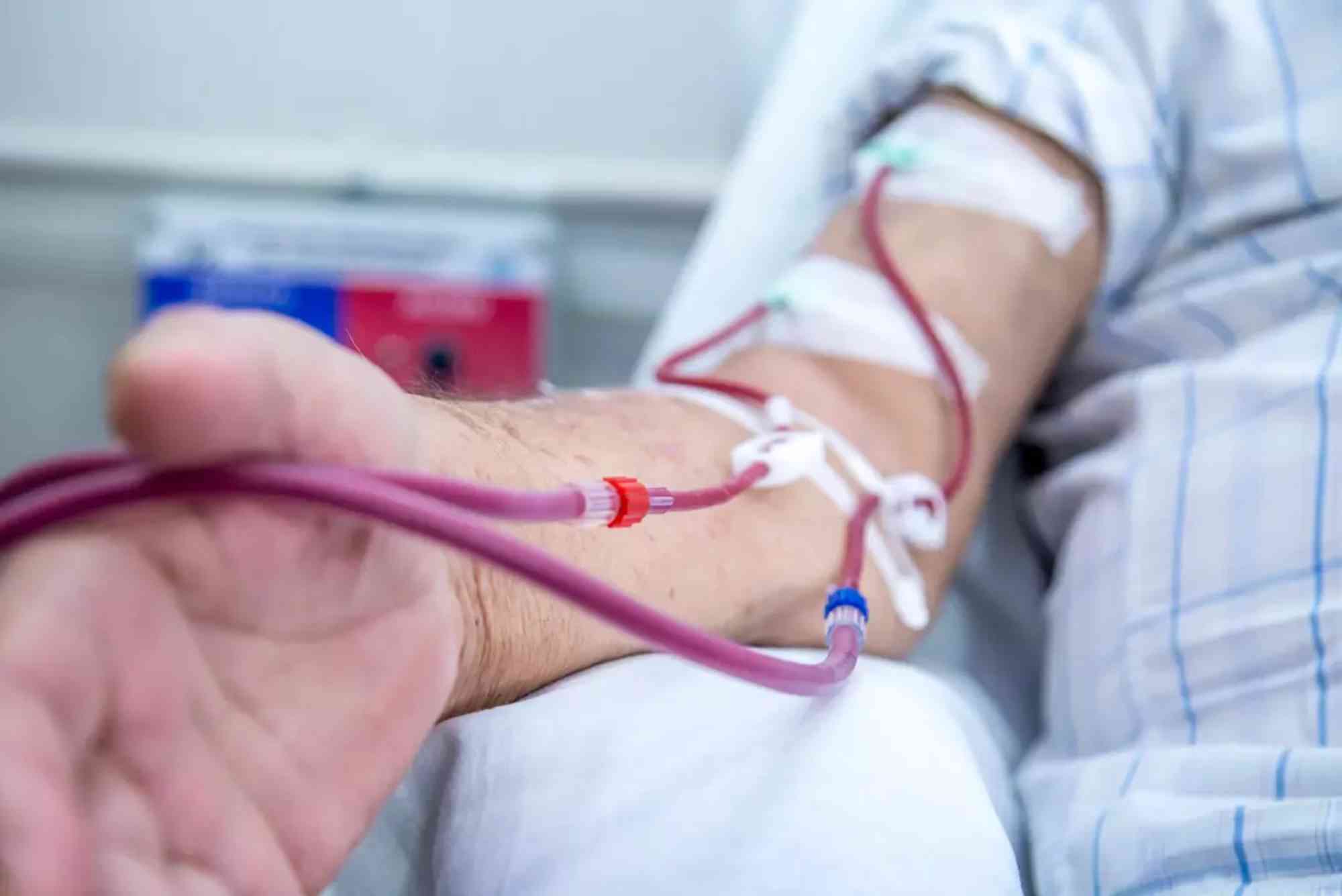 How Much Does a Blood Transfusion Cost Without Insurance?