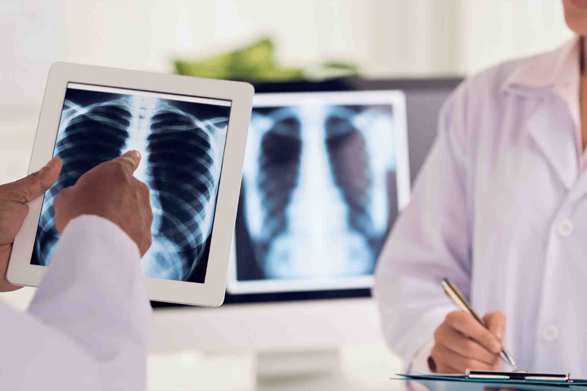 How Much Is an X Ray Without Insurance?