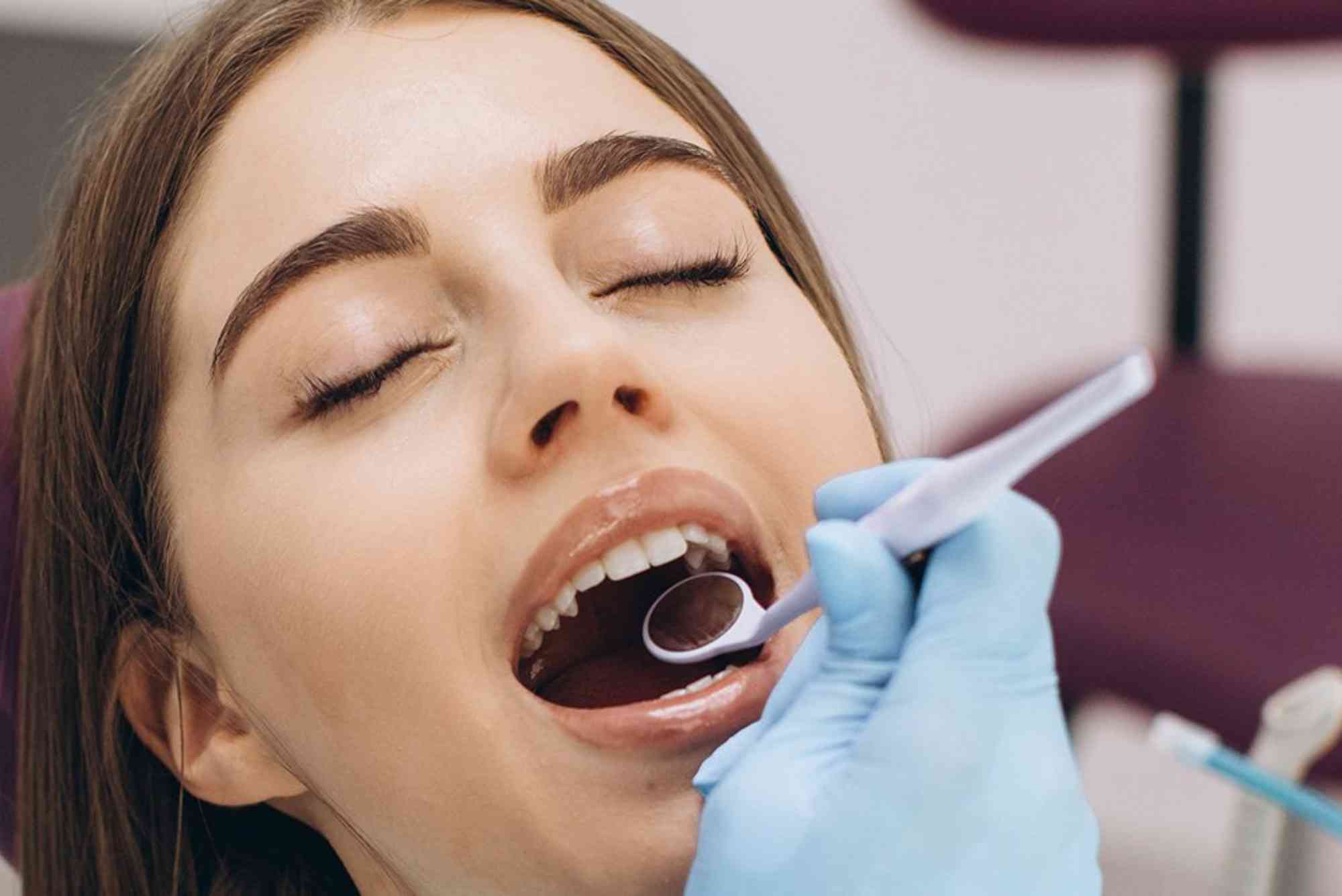 Does Dental Insurance Cover Wisdom Teeth Removal in the UAE