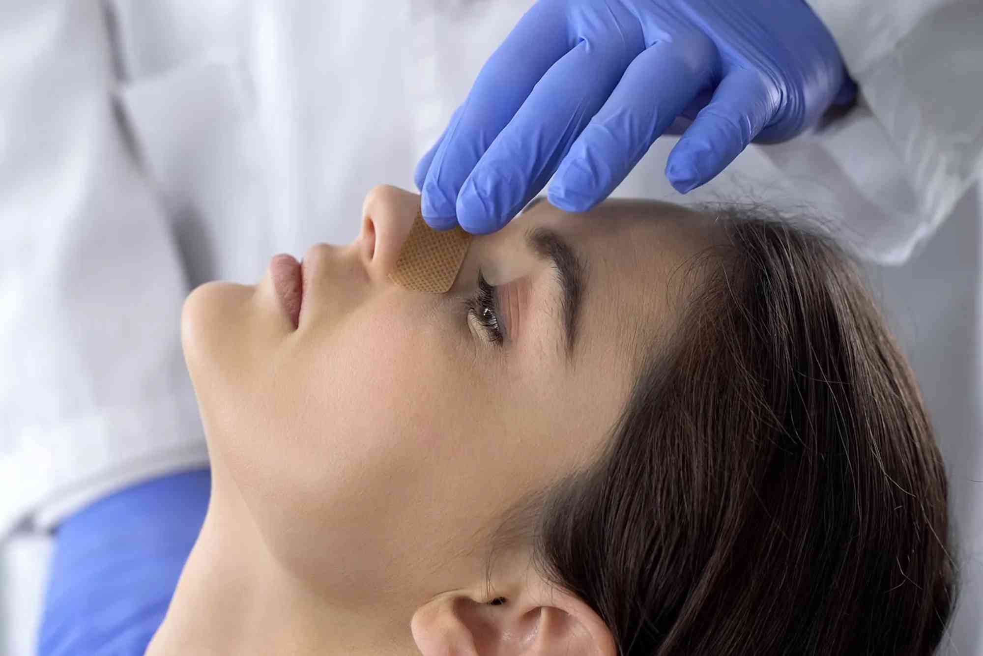 Does Health Insurance Cover Nose Jobs in the UAE